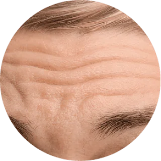 DEEP WRINKLES