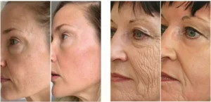 GloraMD-Face-Lift-Serum-Results